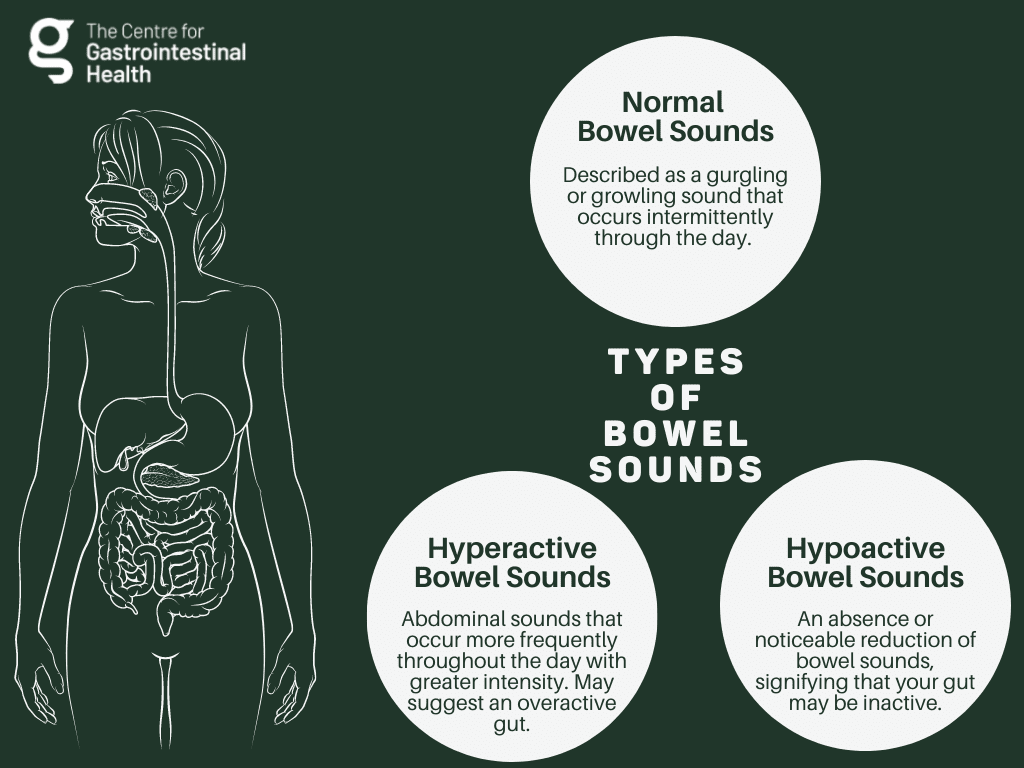 An infographic explaining the three types of bowel sounds and their meanings.